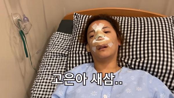 韩女星「鼻子整失败忍10几年」！花80万再动刀　术后照超惊人(图3)