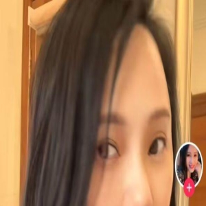 伊能静容貌再遭质疑，人中违和嘴巴变歪，疑似出现整容后遗症