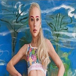 德国模特“断骨长腿”14cm,直言后悔,为迎合丈夫变高却丢了婚姻