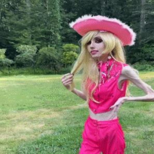 美国网红因太瘦遭抵制,形如骷髅吓坏人:瘦成纸片原来这么可怕!